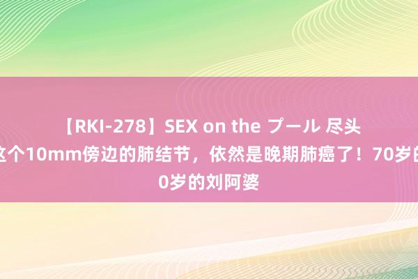 【RKI-278】SEX on the プール 尽头缺憾，这个10mm傍边的肺结节，依然是晚期肺癌了！70岁的刘阿婆